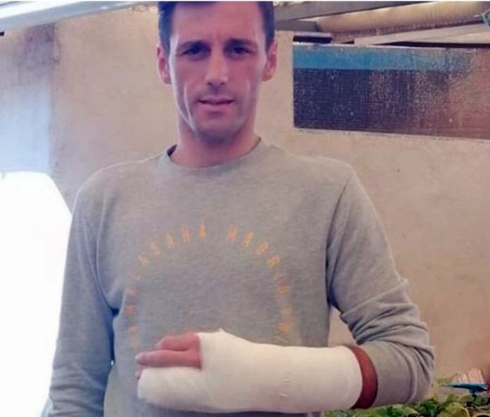 Francisco Montero sufre fractura de falanges